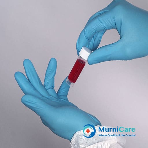 Antibody titer test